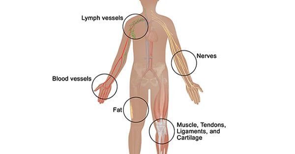 Soft-Tissue-Sarcoma